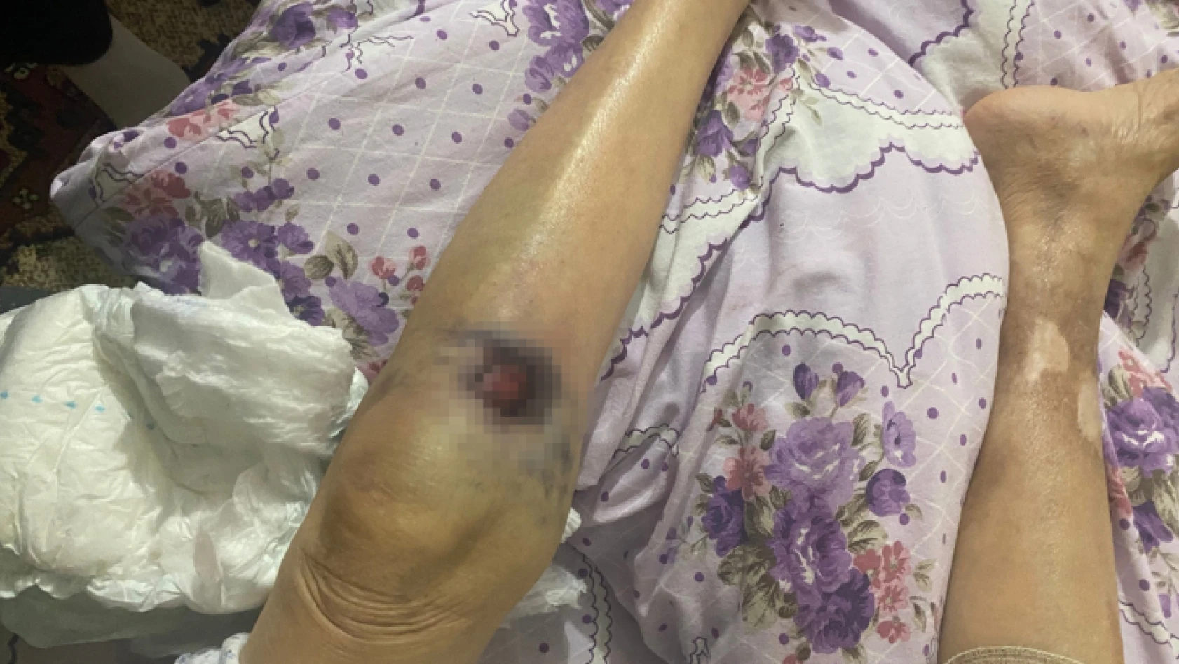 Ankara'da korkunç olay ! Yaşlı kadın bakıcı dehşeti yaşadı