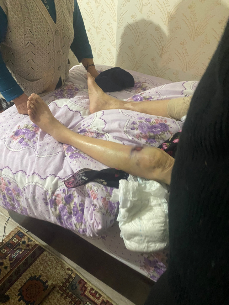 Ankara'da korkunç olay ! Yaşlı kadın bakıcı dehşeti yaşadı